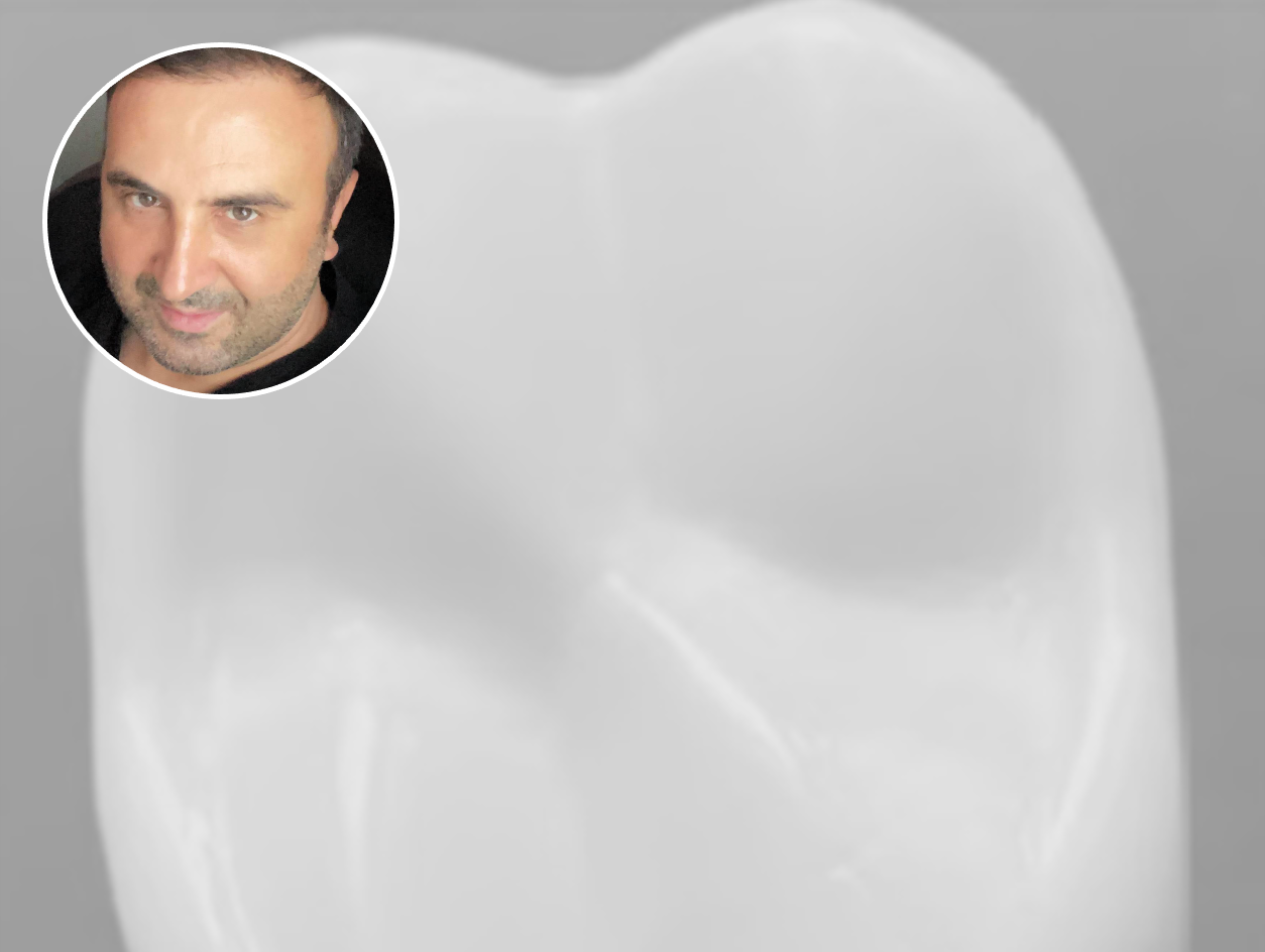 The Effect of Tooth Carving Technique on Dental Technician Student